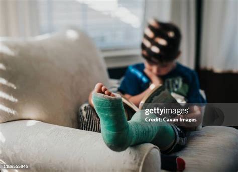 222 Broken Leg Boy Stock Photos, High-Res Pictures, and Images - Getty ...