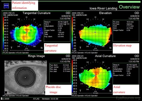 Corneal Imaging An Introduction