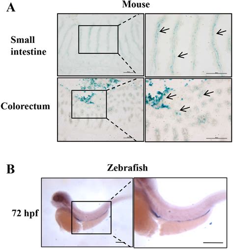 Intestinal Specific Expression Of Erbin In Mouse And Zebrafish A