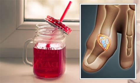 Gout Diet The £1 30 Fruit Juice To Help Avoid Painful Symptoms Uk