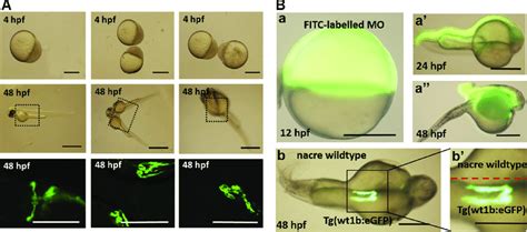 A Pronephros Number And Glomerular Fusion In Parabiotic Zebrafish