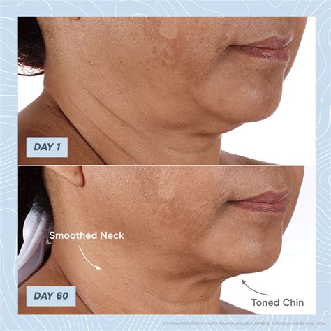 Nuface Depuff Jowls And Contour Cheeks In Minutes Milled