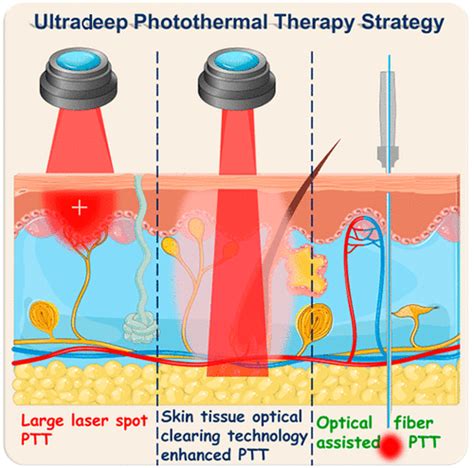 Ultradeep Photothermal Therapy Strategies The Journal Of Physical