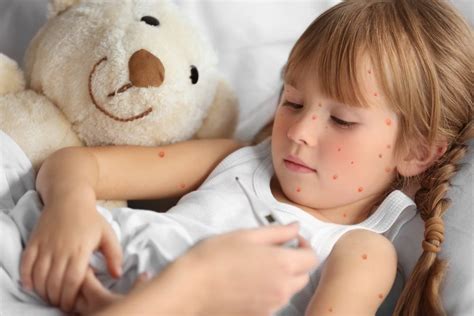 Rash & Other Skin Problems In Children : Overview, Causes, Symptoms ...