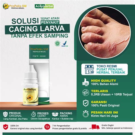 Jual Obat Cacing Larva Pasir Cacing Tambang Di Kulit Propolis Sm