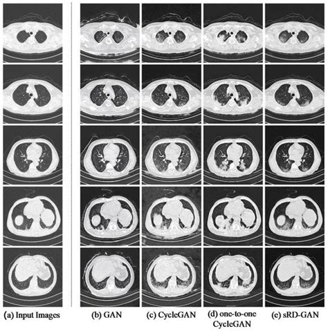 Bioengineering Free Full Text Diverse Covid Ct Image To Image