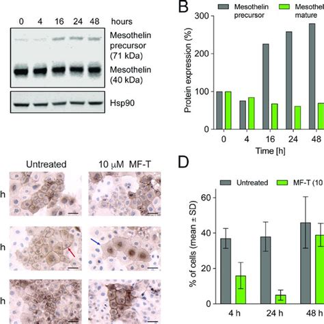 Mesothelin Expression In Ovarian Cancer Cell Line And Patient Derived