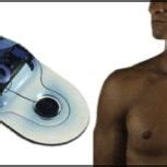 irhythm technologies  sample zio patch report format