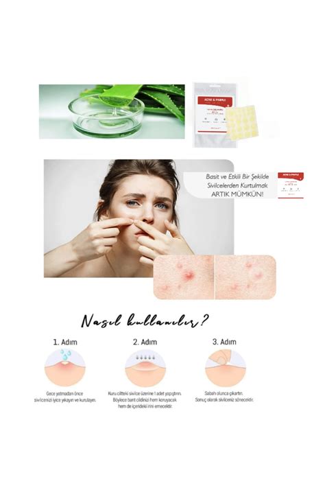 SEUL Acne Pimple Master Patch Acne 36 Patch Akne Ve Sivilce Bandı 2