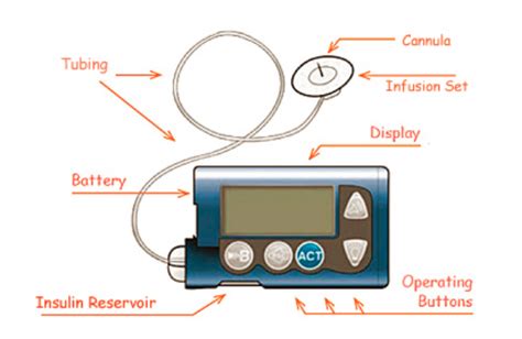 Insulin Pumps Sensors And The Future The Madison Clinic