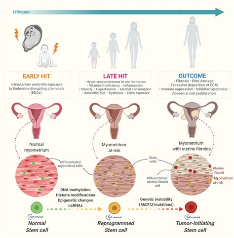 Figure 6 From Comprehensive Review Of Uterine Fibroids Developmental Origin Pathogenesis And