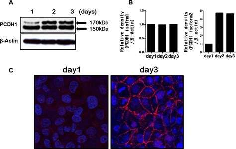 Expression Of Protocadherin 1 Pcdh1 Protein In Human Bronchial