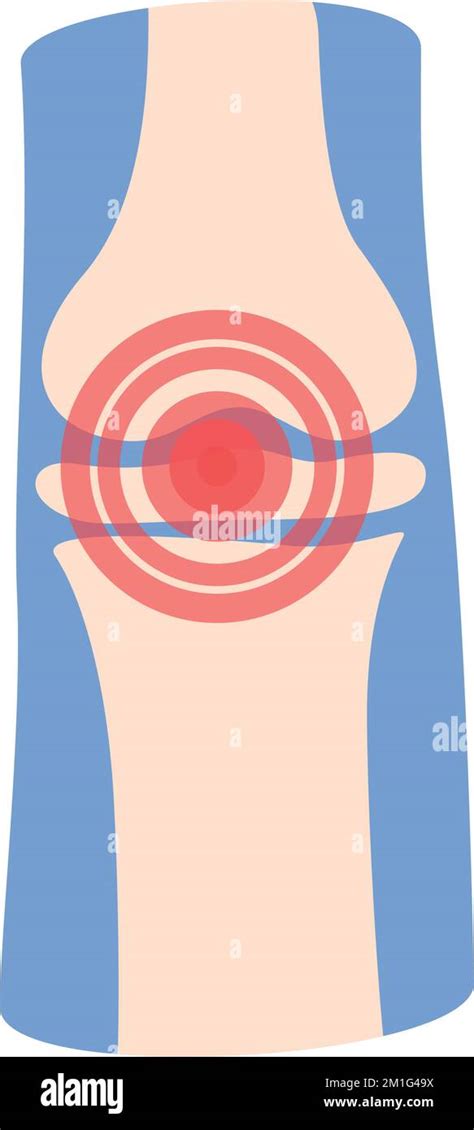 Icono de dolor de rodilla vector de dibujos animados Clínica del