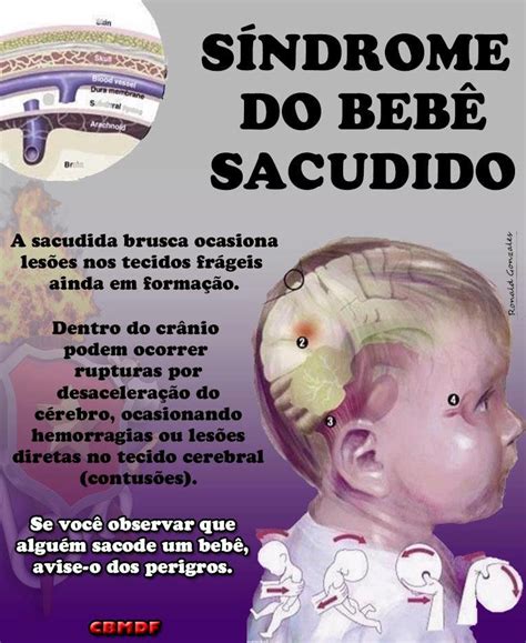 Síndrome do bebê sacudido o que é e como evitar