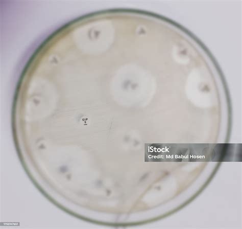 Antimicrobial Susceptibility Testing In Culture Plate Drug Sensitivity