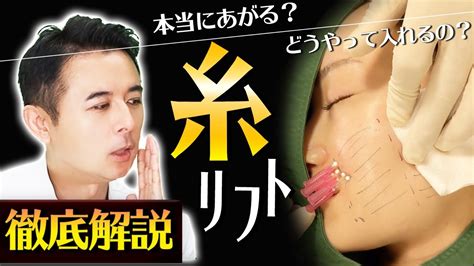 【糸リフト】専門医と経験者が徹底解説！実際どうなの！？ Youtube