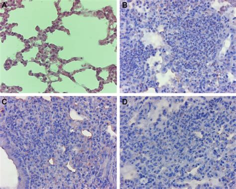 Histological Examination Of Lung Sections H After Bacterial