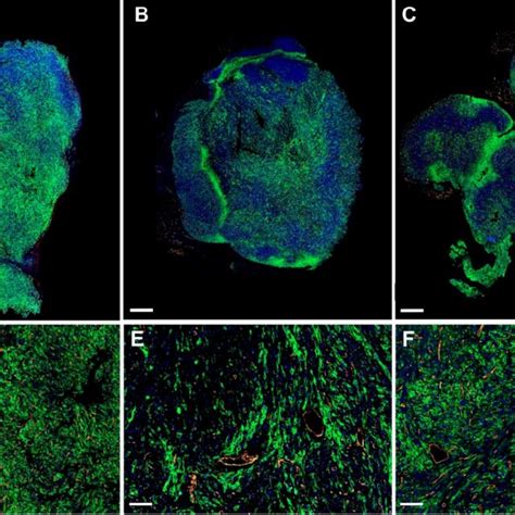 Glut1 And Cd31 Immunofluorescence Representative Sections Of Sdhb Download Scientific Diagram