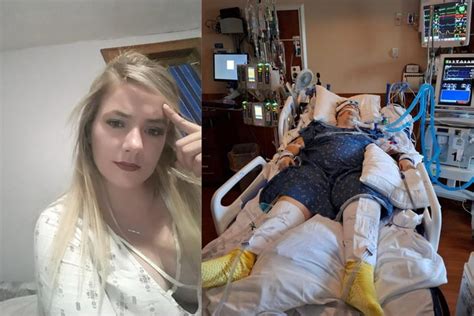 Mulher Fica Dias Em Coma Ap S Colapso Pulmonar Causado Por Vape