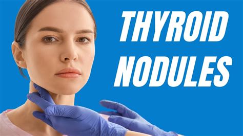 Understanding Thyroid Nodules Causes Symptoms And Treatment Options