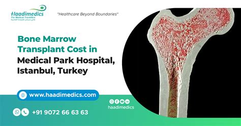 Bone Marrow Transplant Cost In Medical Park Hospital Istanbul Turkey