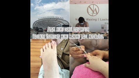 Pengalaman Pertama Perawatan Kuku Di Nails Adoree Pedicure Ingrown