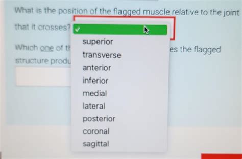 Identify The Specific Structure That Is Flagged Chegg