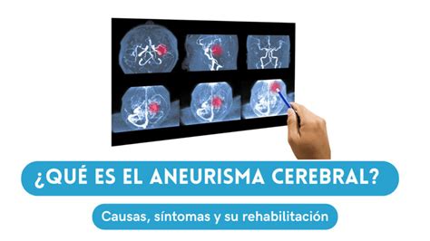 Aneurisma Cerebral Causas síntomas y rehabilitación