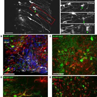 Differentiation Of Blbp Gfp Expressing Cells In Spinal Cord Organotypic