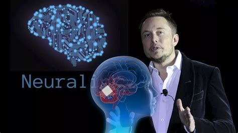 Noticia Neuralink De Elon Musk Implanta El Primer Chip Cerebral En Un