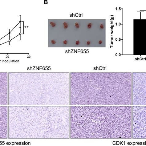 Knockdown Of Znf Attenuates Tumor Formation Of Pancreatic Cancer In