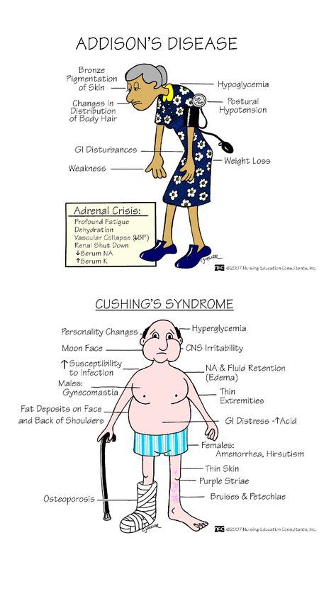 Addison S Disease Nursing Addison S Disease Symptoms Surgical Nursing Hyponatremia