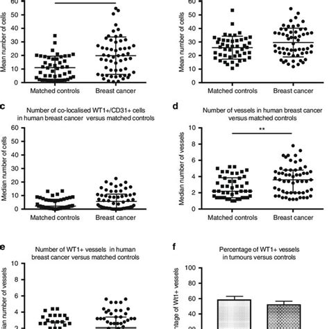 Wt1 Expression Is Increased In Human Breast Cancers Compared With