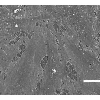 Visualization Of Cell Viability On Uncoated Zirconia After 6 Days By