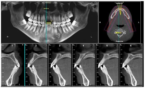 Describe The Purpose And Uses Of Cone Beam Computed Tomography