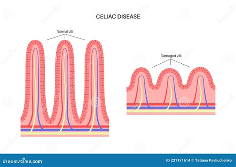 Intestine With Cross Checkmark Grey Icon Diseased Organ Symbol Vector