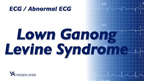 Ecg 35 Lown Ganong Levine Syndrome Youtube