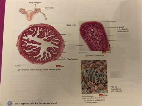 Fallopian Tube Histology