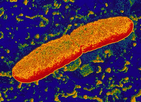 Two Yersinia Pestis Bacteria Photograph by Pasieka