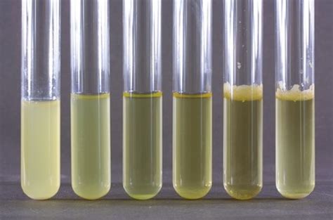 Growth patterns in broth, Thyoglycolate test and Anaerobic jar test ...