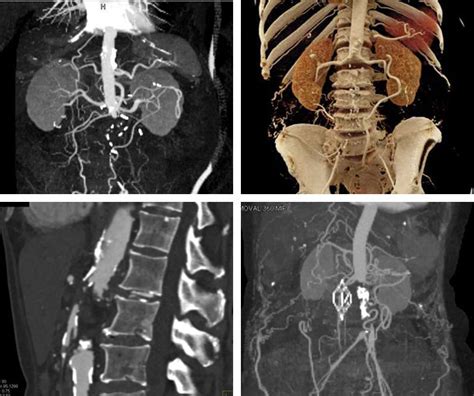 ct quick guides ctisuscom ct scanning