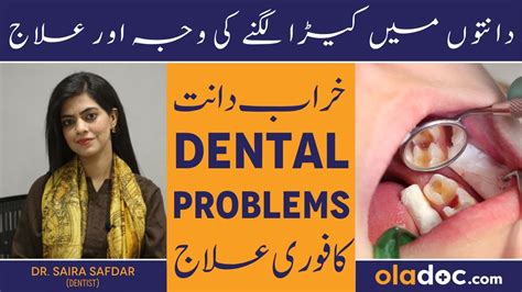 Dant Me Kida Lagne Ka Ilaj Common DENTAL PROBLEMS Urdu Dental