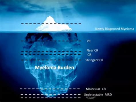 Multiple Myeloma Stringent Complete Very Good Partial