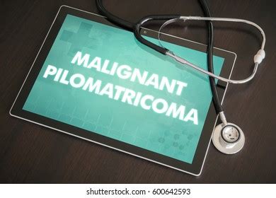 8 Pilomatricoma Images, Stock Photos, 3D objects, & Vectors | Shutterstock