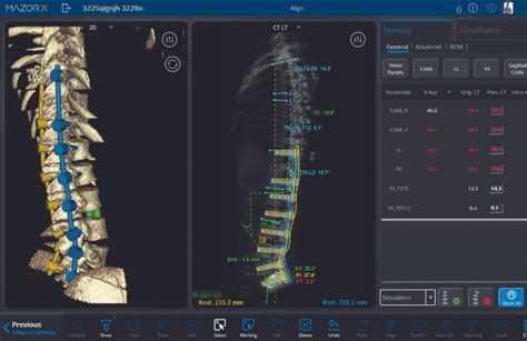 Neurosurgery And Spinal Procedures