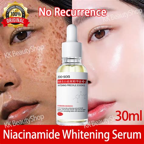 30ml Niacinamide Serum Pekas Remover Whitening Anti Freckle Essence