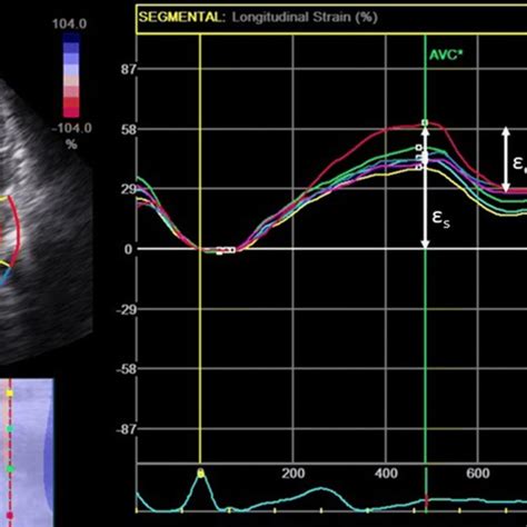 Strain Curves For Six Segments In The Apical Four Chamber View