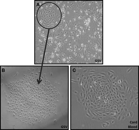 Adult Venous Endothelium Is A Niche For Highly Proliferative And