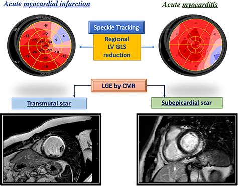 Frontiers Novel Approaches In Cardiac Imaging For Non Invasive