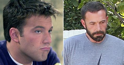 Ben Affleck Hairline Grabs Attention As Jennifer Lopez Romance Rumors Swirl